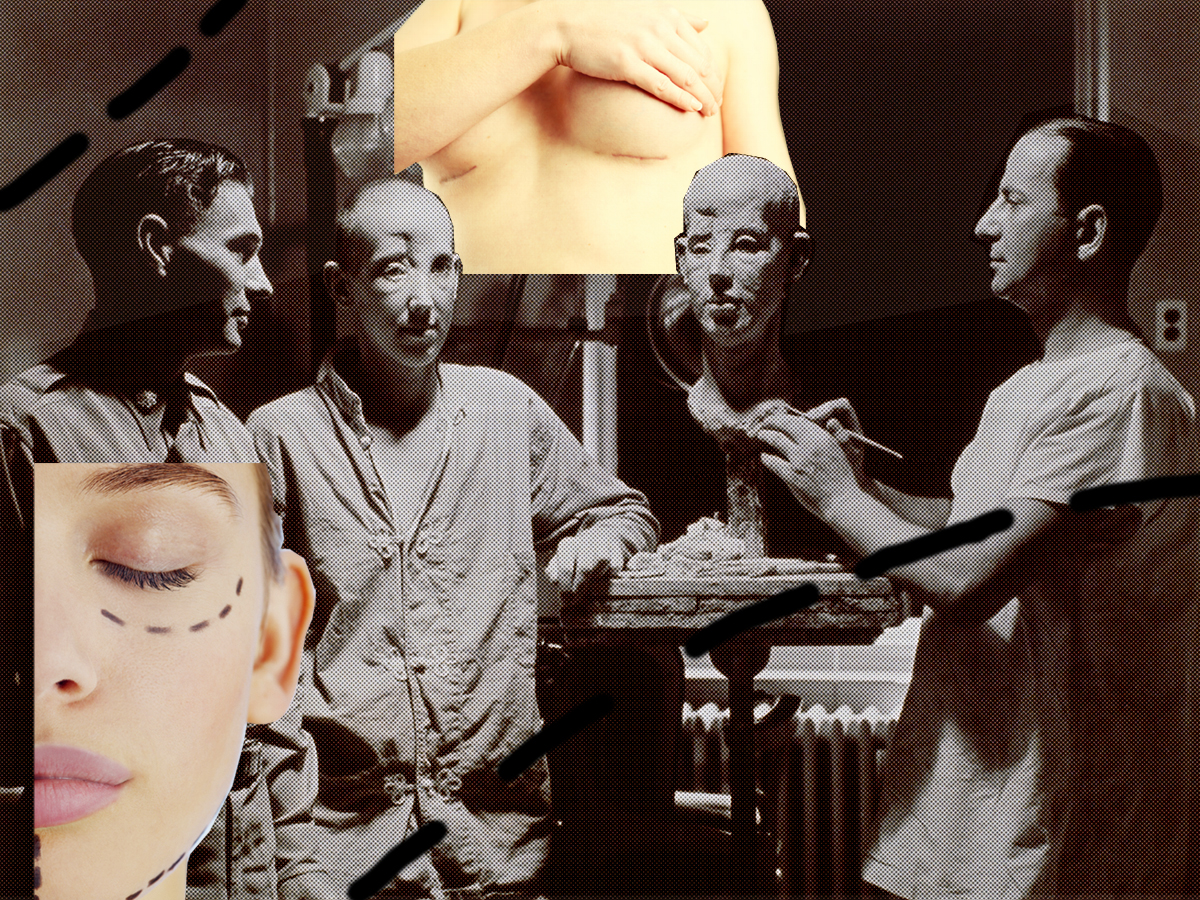 Preparation for Plastic Surgery - Nők Lapja