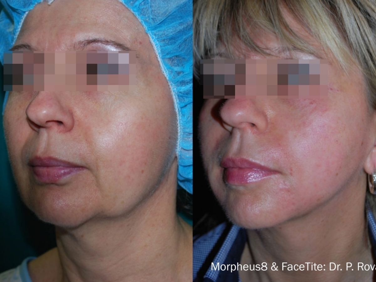 untitled design - 2021-12-16T102813.066 - Nők Lapja