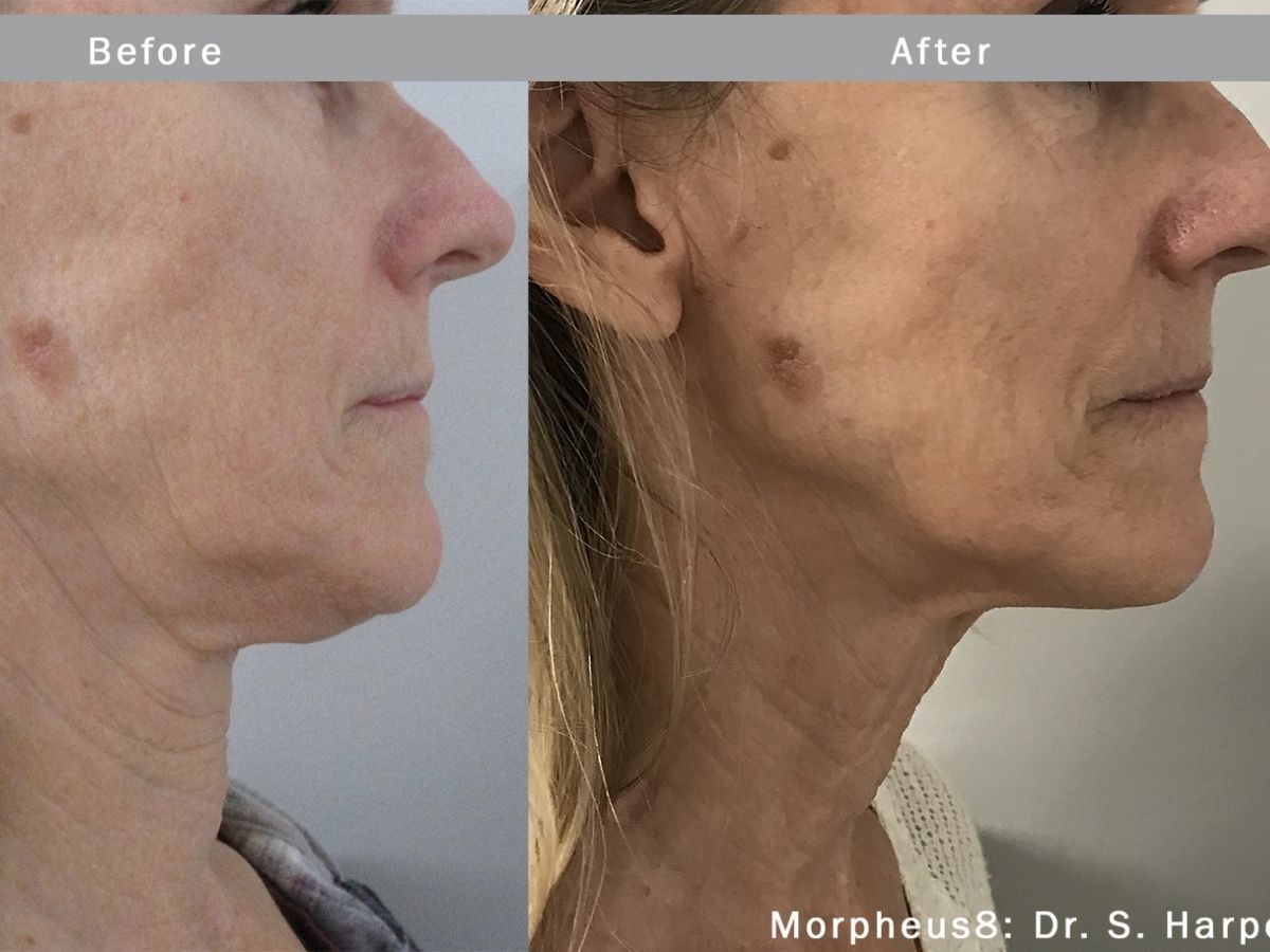 untitled design - 2021-12-16T102849.891 - Nők Lapja