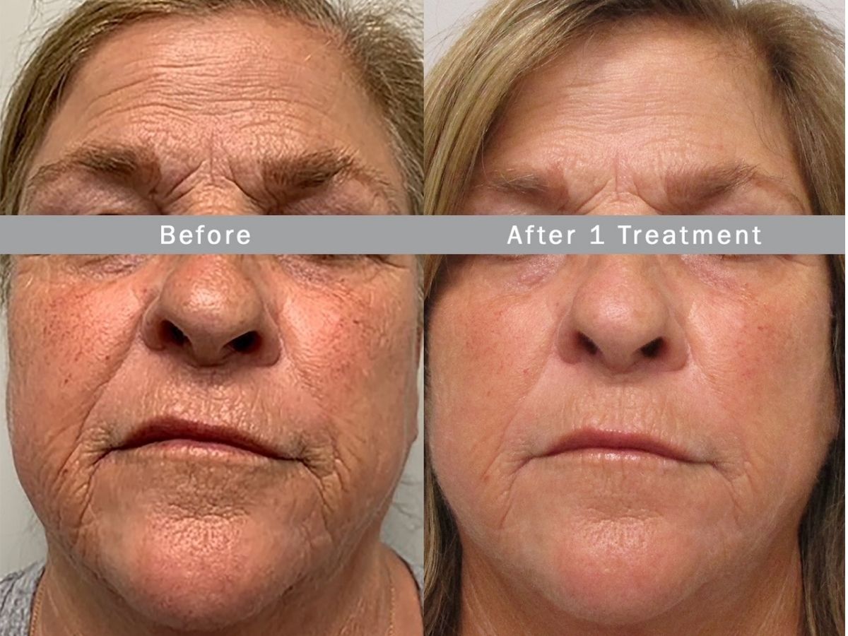 untitled design - 2021-12-16T102913.639 - Nők Lapja