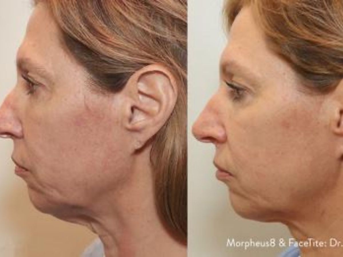 untitled design - 2021-12-16T102946.501 - Nők Lapja