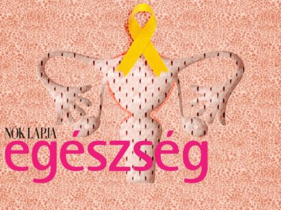 Legyünk jól podcast Nők Lapja Egészség endometriózis