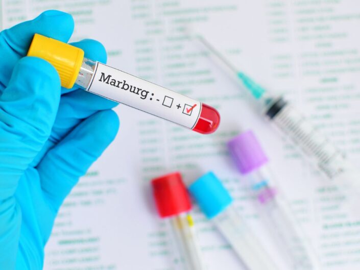 marburg vírus járvány szemvérzés