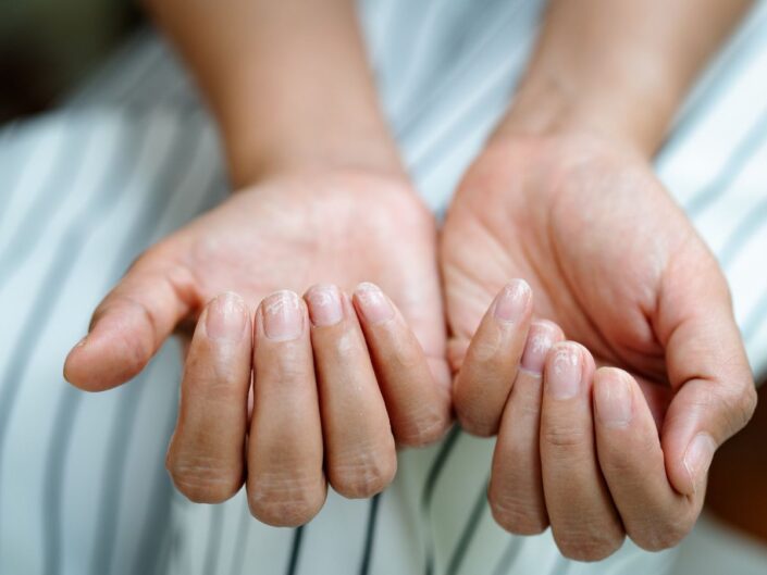 miről árulkodik köröm állapota