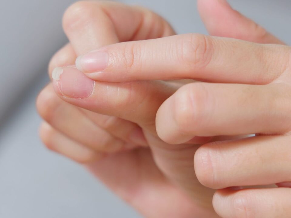 miről árulkodik köröm állapota