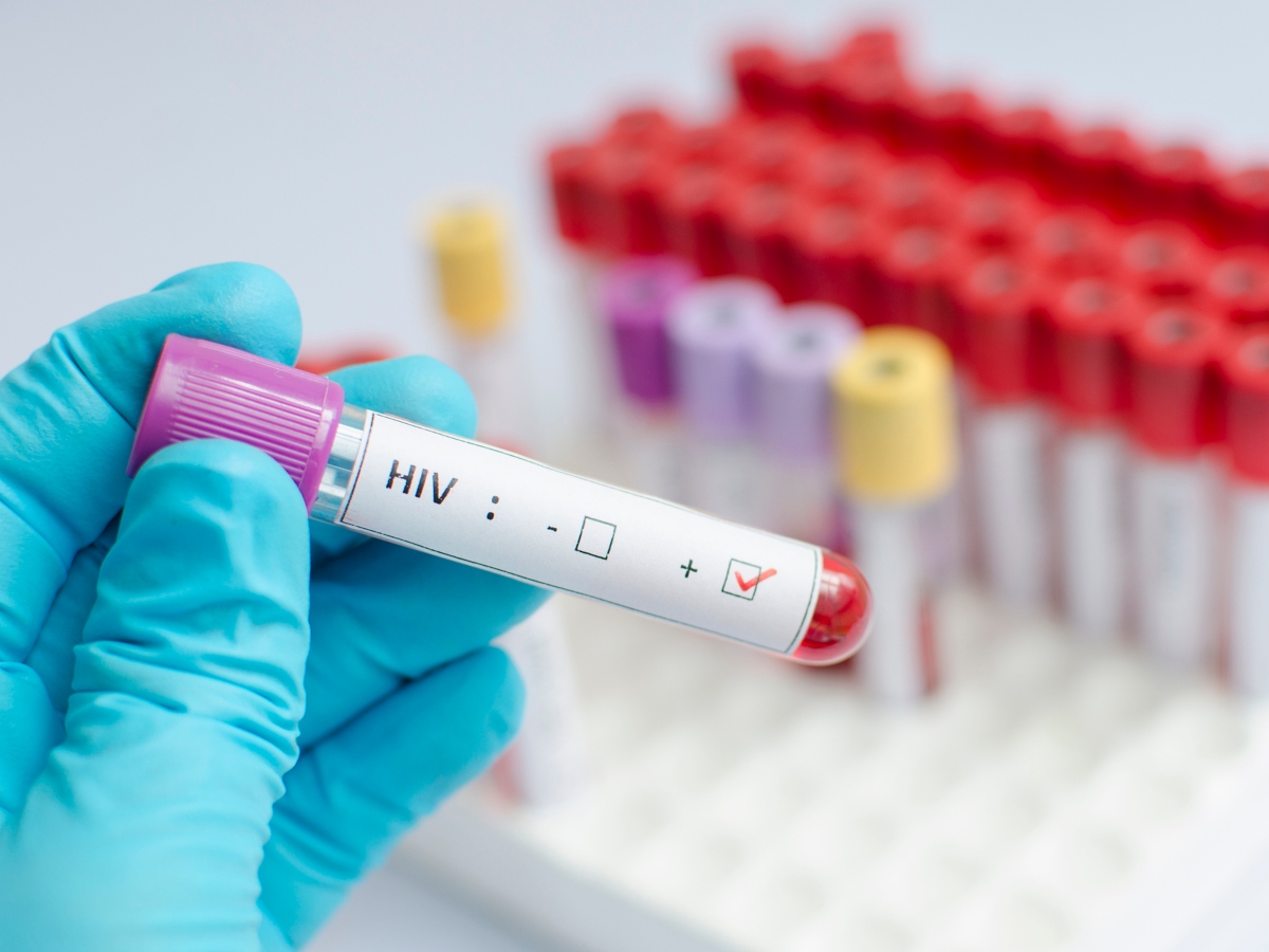 HIV vírus gyógyítás