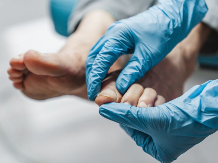 gombás lábköröm kesztyű orvos vizsgálat