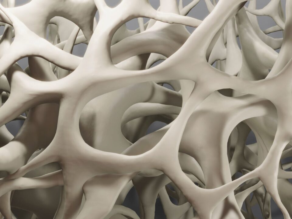 csont csontritkulás