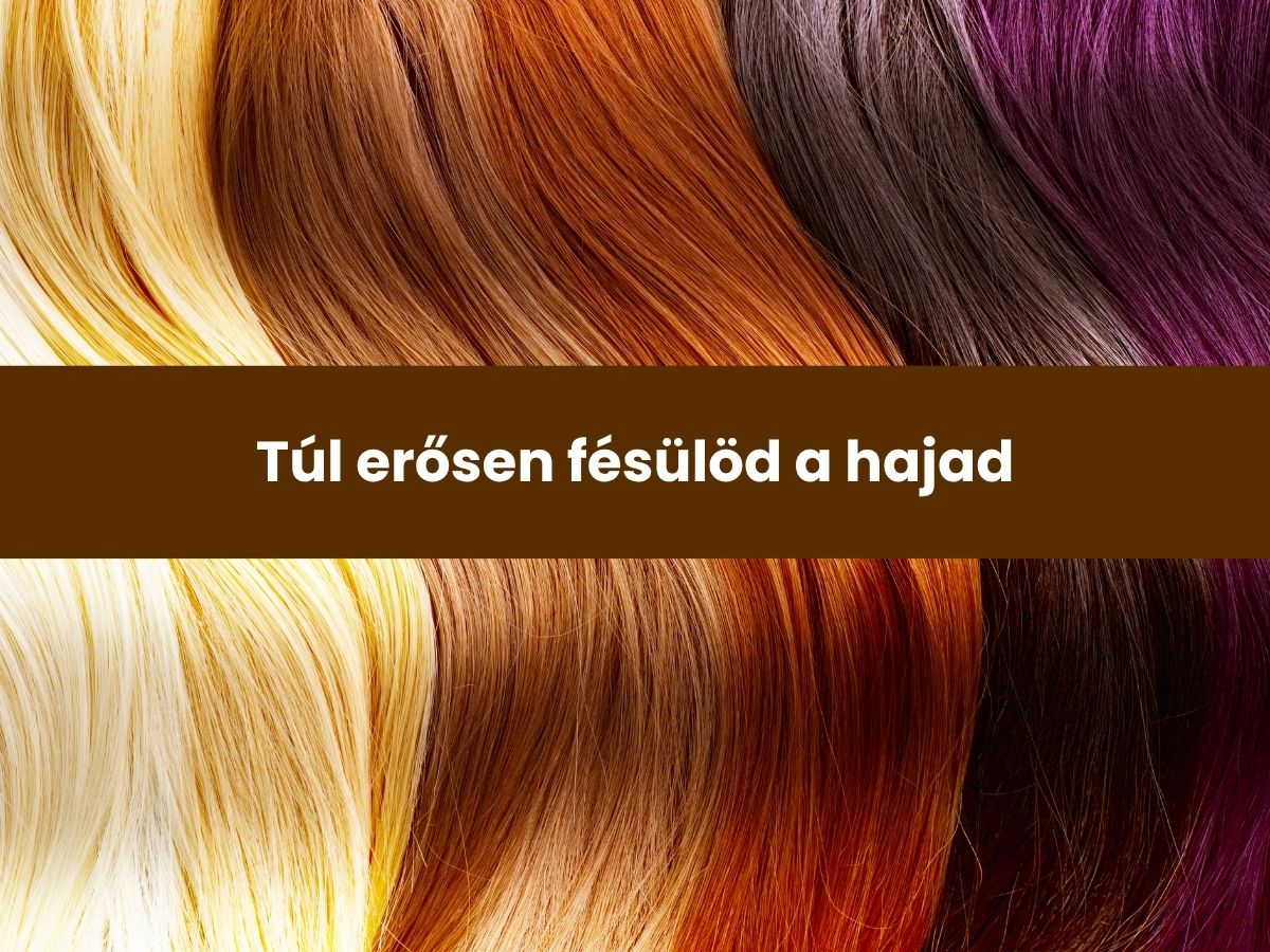 Túl erősen fésülöd a hajad