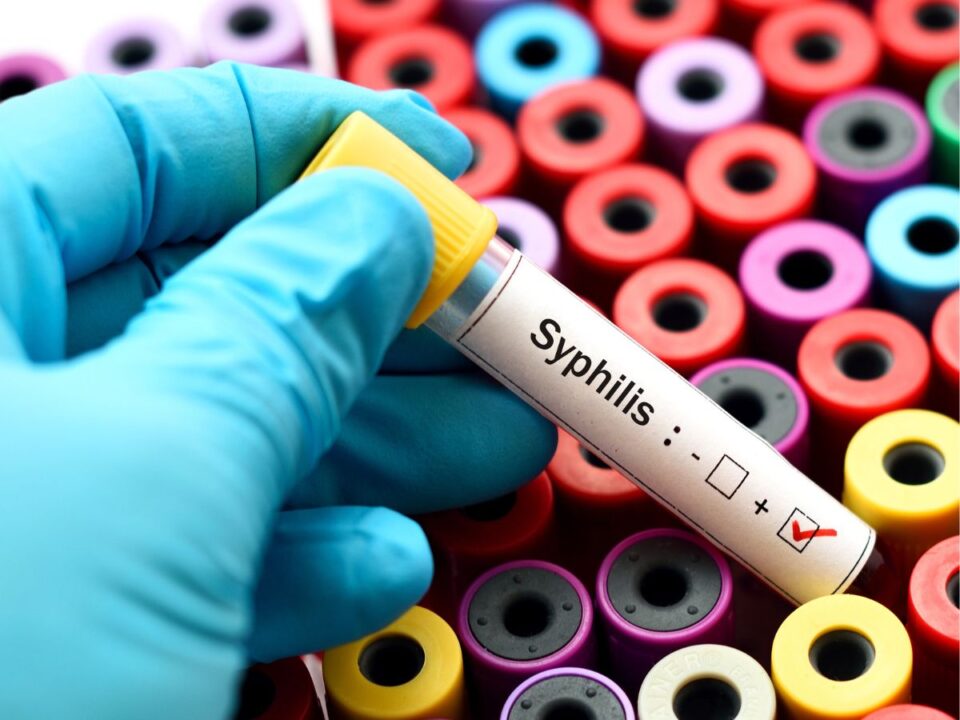 nemi-betegseg-szifilisz-szures-idopont1 - Nők Lapja szifilisz