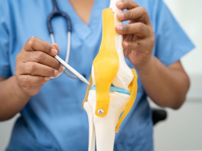 orvos térdízületet mutat