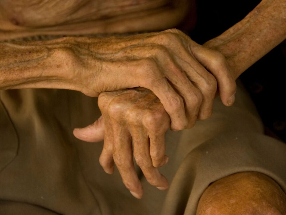 alice-augusta-ball-tortenete - Nők Lapja leprával küzdő beteg keze