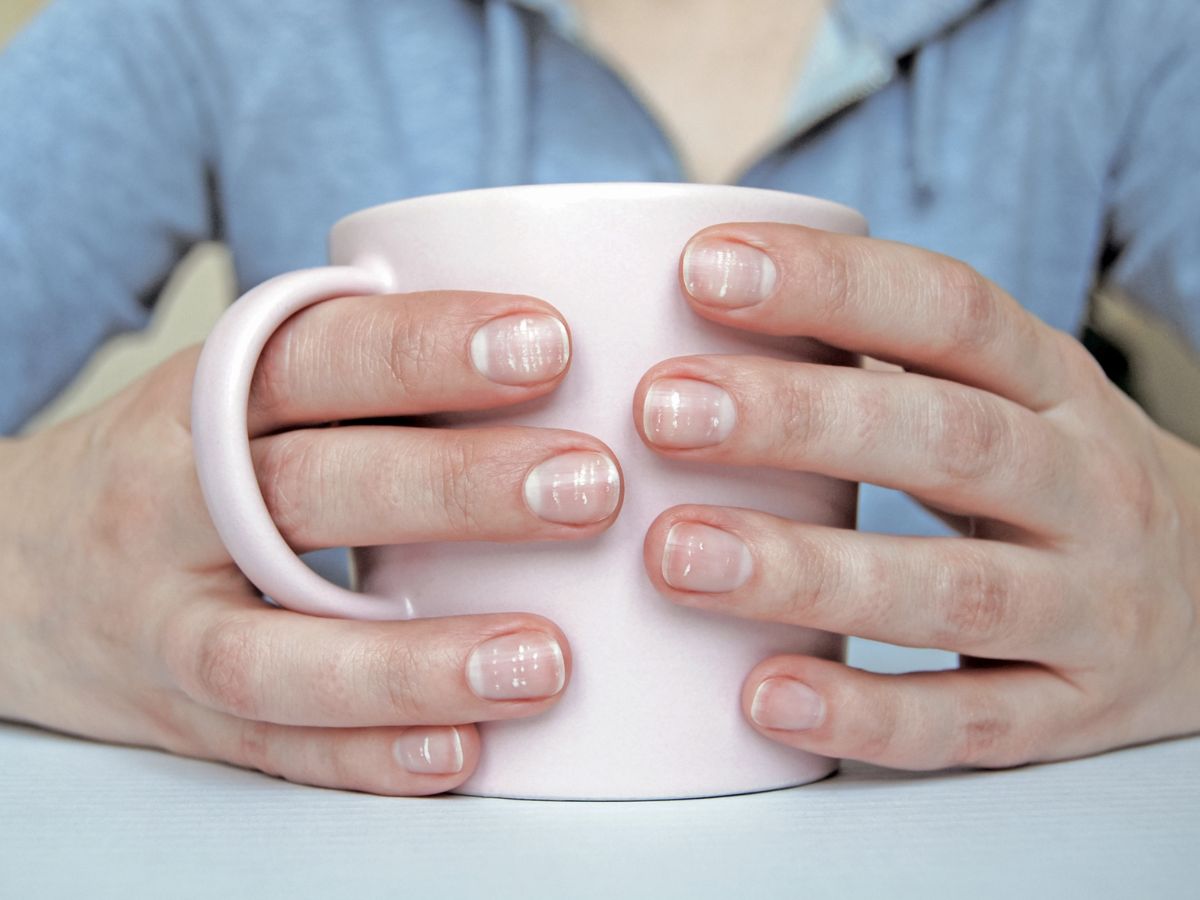 fehér foltos köröm