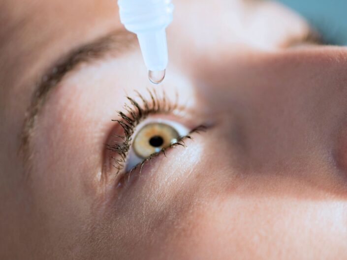 nő cseppent szempcseppet a szemébe