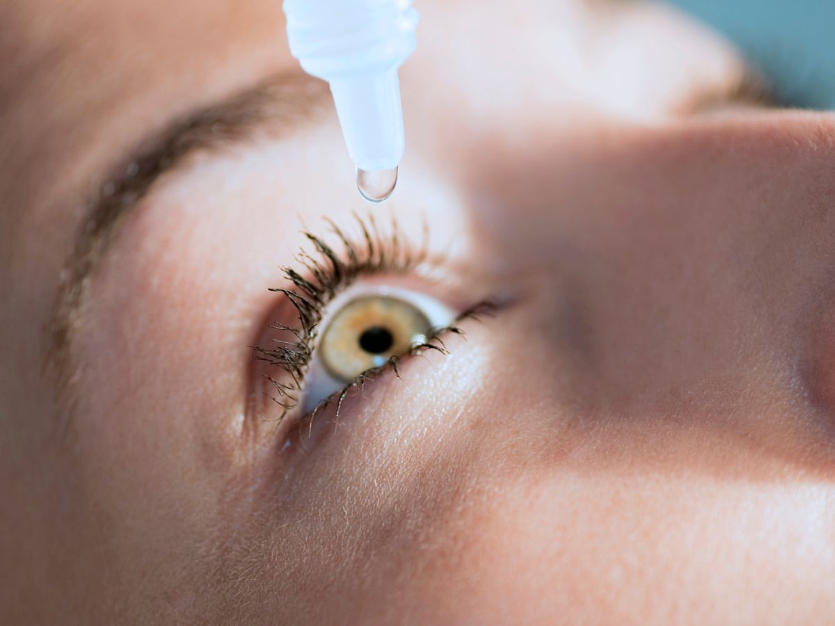 nő cseppent szempcseppet a szemébe