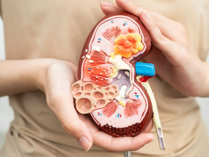 vese szerv modellezve