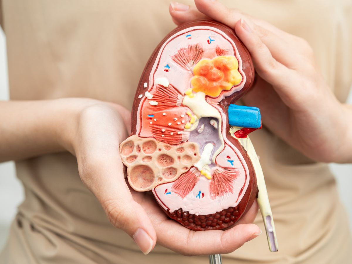 vese szerv modellezve