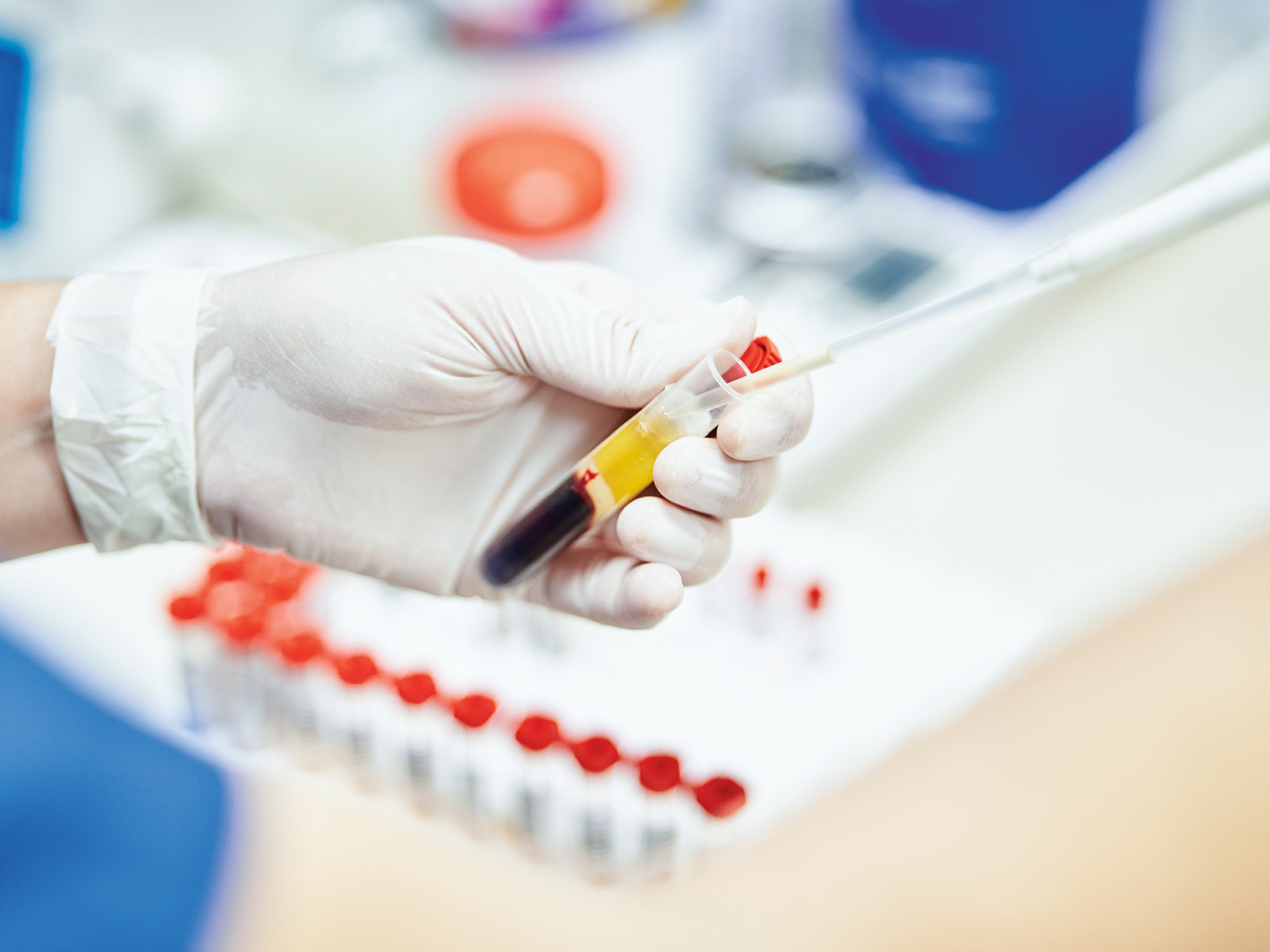egy kémcsőből szívnak fel vérplazmát