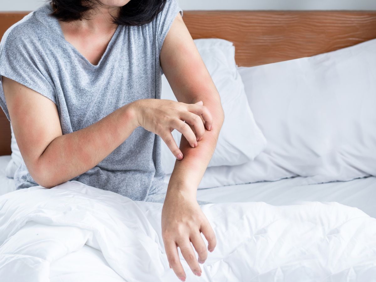 Nő ágyi poloska csípésének helyét vakarja az ágyban ülve