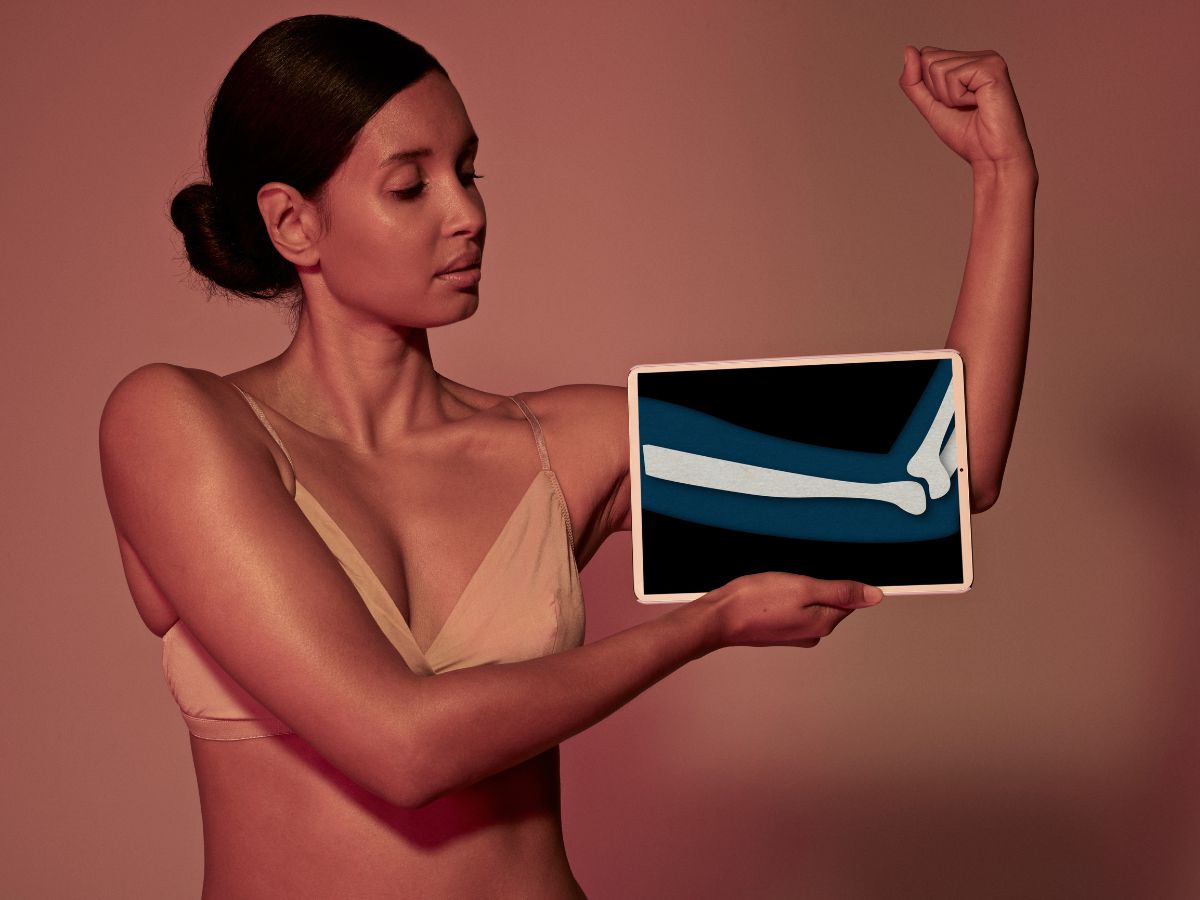 Nő tableten felkarcsont röntgenképét tartja a karja elé