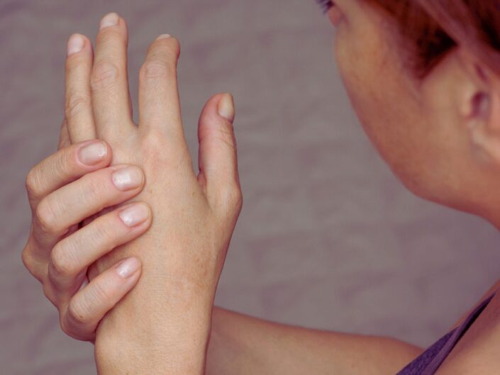 női kezek, az egyik masszírozza a másikat