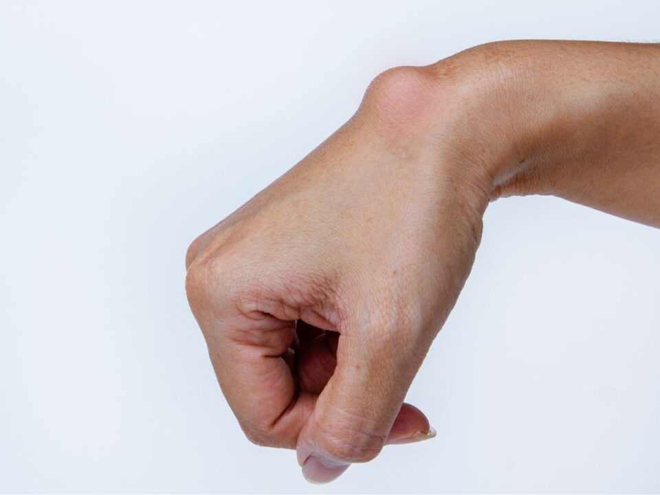 ujjfajdalom-kez-mobilitas - Nők Lapja gangolin ciszta a kézen