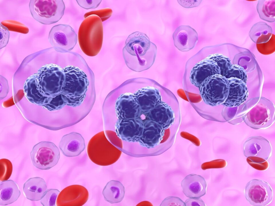 t-sejtes-limfoma - Nők Lapja T-sejtes limfóma számítógépes illusztráció