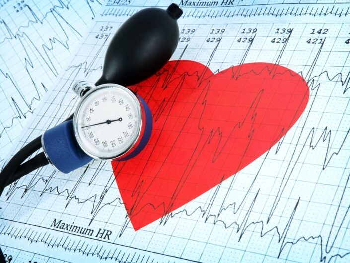 EKG papír, piros szív, vérnyomásmérő pumpája és órája