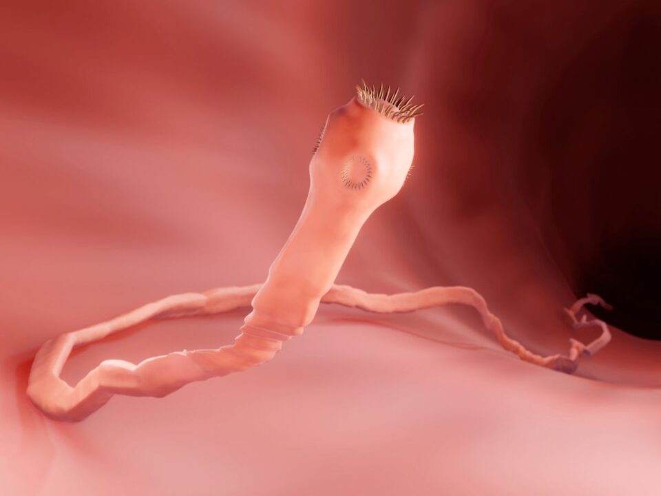 sertesparazita-agy-fertozes - Nők Lapja galandféreg a bélben, illusztráció