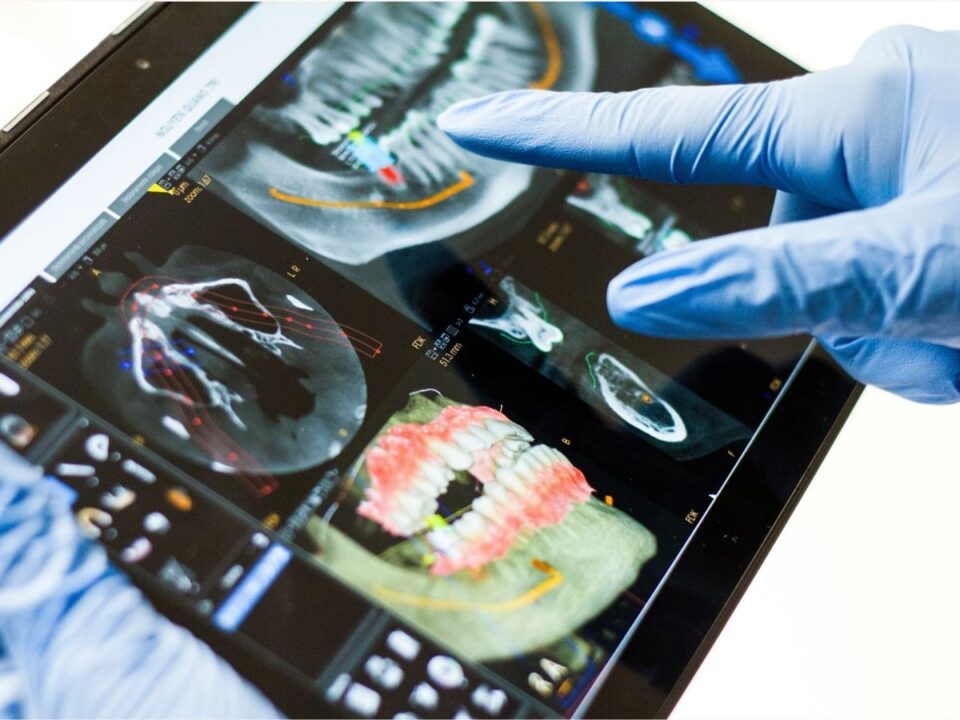 fogpotlas-kutatas - Nők Lapja Fogorvos beteg digitális képalkotóval készült leeltét nézi tableten