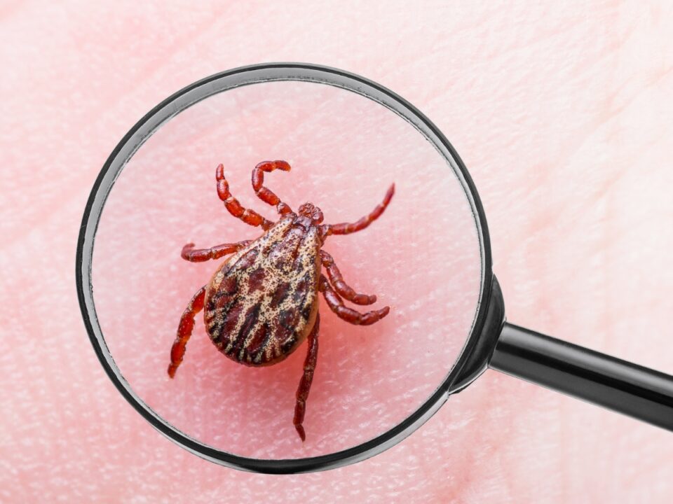 kullancscsipes-husallergia-alfa-gal - Nők Lapja Barna, mintás hátú kullancs látható rózsaszín emberi bőrön, fekete nyelű nagyítóval felnagyítva, jól kivehető testtel és nyolc lábbal.