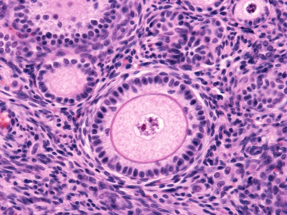 petefeszek-menopauza - Nők Lapja petefészek